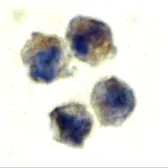 Anti-IL22 Receptor alpha 1 antibody used in Immunocytochemistry/ Immunofluorescence (ICC/IF). GTX16978