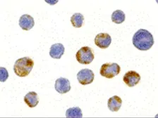 Anti-AES antibody used in Immunocytochemistry/ Immunofluorescence (ICC/IF). GTX16982