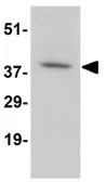 Anti-DARC antibody used in Western Blot (WB). GTX16988
