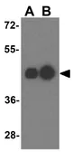 Anti-DARC antibody used in Western Blot (WB). GTX16989