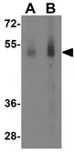 Anti-FEZ1 antibody used in Western Blot (WB). GTX16992