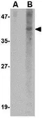 Anti-NANOS1 antibody used in Western Blot (WB). GTX17009