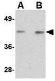 Anti-NANOS1 antibody used in Western Blot (WB). GTX17010
