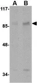 Anti-AAK1 antibody used in Western Blot (WB). GTX17021