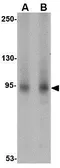 Anti-AAK1 antibody used in Western Blot (WB). GTX17023
