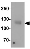 Anti-LEMD3 antibody used in Western Blot (WB). GTX17158
