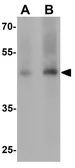 Anti-GDF1 antibody used in Western Blot (WB). GTX17181