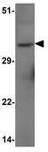 Anti-FOXH1 antibody used in Western Blot (WB). GTX17182