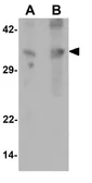 Anti-GRINA antibody used in Western Blot (WB). GTX17187