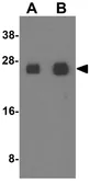 Anti-Connexin 26 antibody used in Western Blot (WB). GTX17229