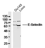Anti-CD62E antibody used in Western Blot (WB). GTX17548