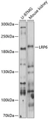 Anti-LRP6 antibody used in Western Blot (WB). GTX17568