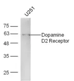 Anti-Dopamine Receptor D2 antibody used in Western Blot (WB). GTX17570