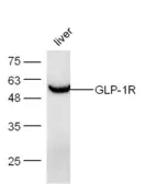Anti-GLP1R antibody used in Western Blot (WB). GTX17604