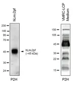 Anti-Laminin gamma 2 antibody [P2H] used in Western Blot (WB). GTX17686