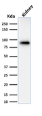 Anti-Calnexin antibody [CANX/1543] used in Western Blot (WB). GTX17859