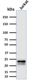Anti-CD3 epsilon antibody [C3e/2478] used in Western Blot (WB). GTX17864