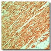 Anti-Muscle Actin antibody [3F10] used in IHC (Paraffin sections) (IHC-P). GTX18146