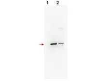 Anti-FBXW11 antibody used in Western Blot (WB). GTX18150