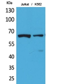 Anti-NFkB p65 (acetyl Lys218) antibody used in IHC (Paraffin sections) (IHC-P). GTX20307