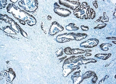 Anti-p53 antibody [DO-7] (ready-to-use) used in IHC (Paraffin sections) (IHC-P). GTX20911