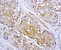IHC（石蜡切片）中使用的抗-MMP9抗体（IHC-P）。GTX22167型