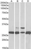 Anti-PGAM1 / PGAM2 / PGAM4 antibody, C-term used in Western Blot (WB). GTX22220