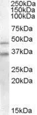 Anti-GULP1 antibody, C-term used in Western Blot (WB). GTX22751