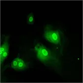 Anti-Importin beta 1 antibody [3E9] used in Immunocytochemistry/ Immunofluorescence (ICC/IF). GTX22811