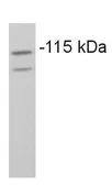 Anti-COPB antibody used in Western Blot (WB). GTX22915