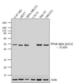 Anti-PPAR alpha (phospho Ser12) antibody used in Western Blot (WB). GTX23484
