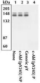 Anti-c-Abl (phospho Tyr245) antibody used in Western Blot (WB). GTX24479