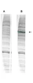 Anti-WHIP antibody used in Western Blot (WB). GTX24731