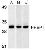 Anti-ANP32A antibody used in Western Blot (WB). GTX25991