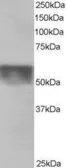 Anti-KPNA4 antibody, C-term used in Western Blot (WB). GTX26039