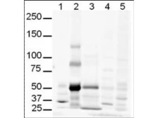 Anti-GLI3 antibody used in Western Blot (WB). GTX26050