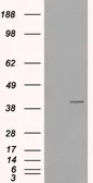 Anti-VPS26A antibody, C-term used in Western Blot (WB). GTX26051