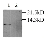 Anti-RANTES antibody used in Western Blot (WB). GTX27198