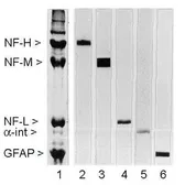 Anti-NF-M antibody [3H11] used in Western Blot (WB). GTX27256