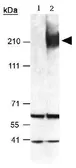Western Blot（WB）中使用的抗-ABCA1抗体。GTX27360型