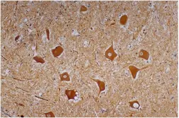 Anti-NF-H antibody [NF-01] used in IHC (Paraffin sections) (IHC-P). GTX27795