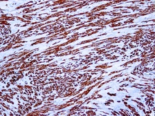 Anti-Muscle Actin antibody [HHF35] used in IHC (Paraffin sections) (IHC-P). GTX27813
