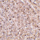 Anti-Caspase 12 antibody used in IHC (Paraffin sections) (IHC-P). GTX28117