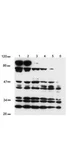 Anti-NOTCH2 antibody used in Western Blot (WB). GTX28927