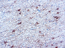 Anti-GFAP antibody [GA5] (ready-to-use) used in IHC (Paraffin sections) (IHC-P). GTX29551