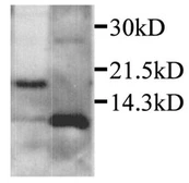 Anti-CXCL2 / GRO beta antibody used in Western Blot (WB). GTX29777