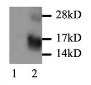Anti-MCP1 / CCL2 antibody used in Western Blot (WB). GTX29779