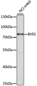 Anti-BVES antibody used in Western Blot (WB). GTX30098