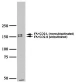 Anti-FANCD2 antibody used in Western Blot (WB). GTX30142