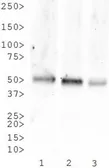 Anti-Neurokinin 1 Receptor antibody used in Western Blot (WB). GTX30183